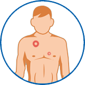 Mann mit Ringelflechte auf der Brust