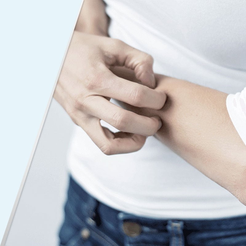 Symptome von Ringelflechte